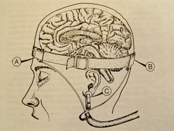 Brain Electrodes